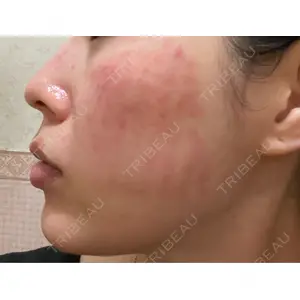 Belle Via Skin Clinic口コミ