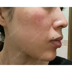 Belle Via Skin Clinic口コミ