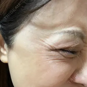 Natural Skin Clinic Natural Skin Clinic 笹塚院口コミ