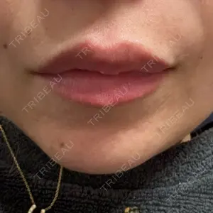 アリエル美容クリニック アリエル美容クリニック 水戸院口コミ