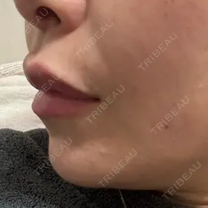 アリエル美容クリニック アリエル美容クリニック 水戸院口コミ