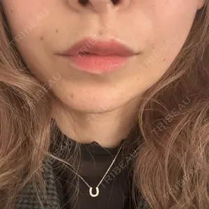 アリエル美容クリニック アリエル美容クリニック 水戸院口コミ