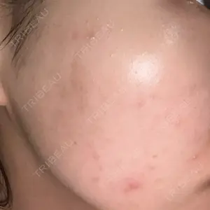 ルラ美容クリニック ルラ美容クリニック 大宮院 / ルラスキンクリニック 大宮院口コミ