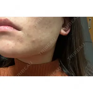 フィラークリニック フィラークリニック 名古屋栄院口コミ