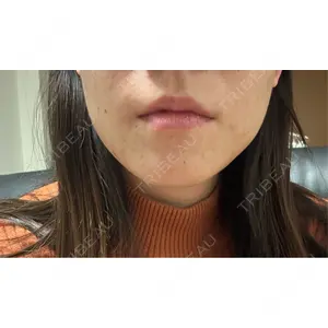 フィラークリニック フィラークリニック 名古屋栄院口コミ