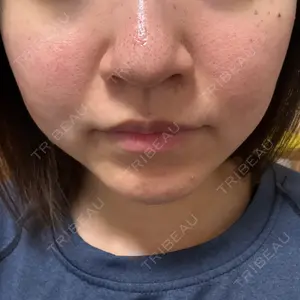 おおかみ美容のクリニック おおかみ美容のクリニック 横浜院口コミ