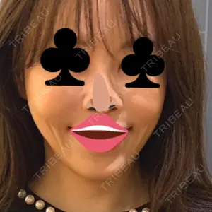 HINATA クリニック口コミ