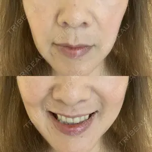 ASTRA BEAUTY CLINIC口コミ