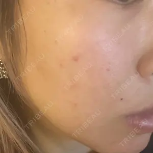 ゆきスキンクリニック 東池袋口コミ