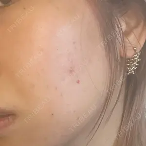 ゆきスキンクリニック 東池袋口コミ