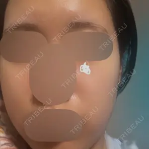 Re:anne clinic 銀座 【リアンクリニック銀座】口コミ