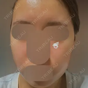 Re:anne clinic 銀座 【リアンクリニック銀座】口コミ