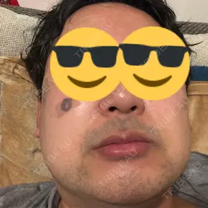 BBC BBC銀座院口コミ
