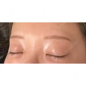 design beauty clinic 梅田本院口コミ