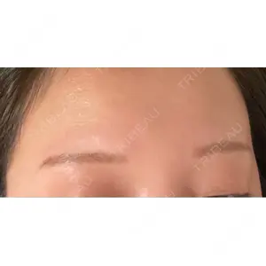 design beauty clinic 梅田本院口コミ