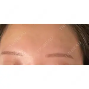 design beauty clinic 梅田本院口コミ