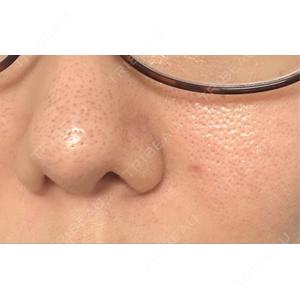NARU Beauty Clinic NARU Beauty Clinic 【ナルクリ】口コミ