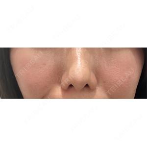 NARU Beauty Clinic NARU Beauty Clinic 【ナルクリ】口コミ