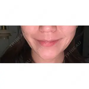 TAクリニック 札幌TAクリニック口コミ