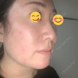 TCB東京中央美容外科 TCB東京中央美容外科 銀座有楽町院口コミ