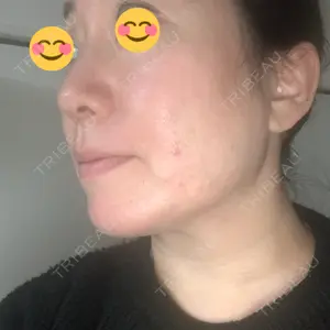 TCB東京中央美容外科 TCB東京中央美容外科 銀座有楽町院口コミ