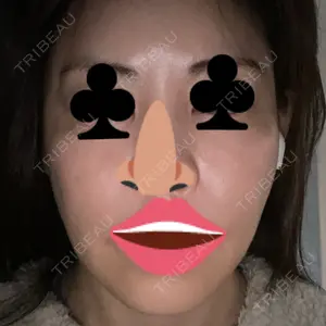 HINATA クリニック口コミ