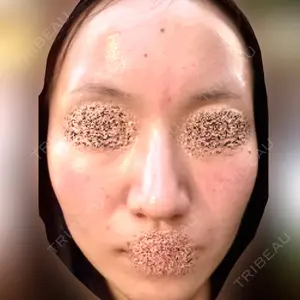 ゆきスキンクリニック 東池袋口コミ