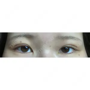 大塚美容形成外科 大塚美容形成外科 銀座本院口コミ