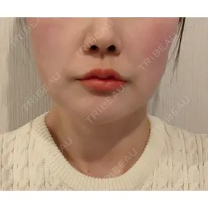 THE CLINIC THE CLINIC（ザ・クリニック） 大阪院口コミ