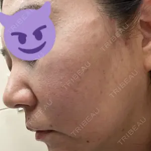 TCB東京中央美容外科 TCB東京中央美容外科 水戸院口コミ