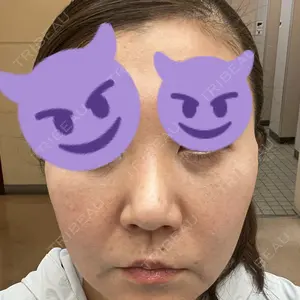 TCB東京中央美容外科 TCB東京中央美容外科 水戸院口コミ