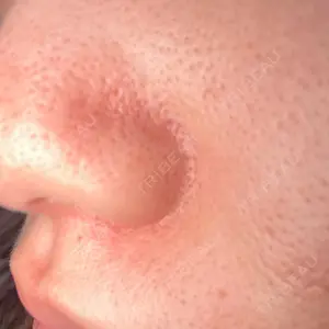 心斎橋KT美容クリニック口コミ