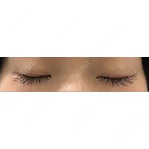 BIANCA CLINIC BIANCA銀座口コミ