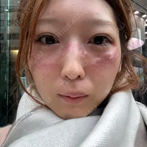 APスキンクリニック銀座口コミ