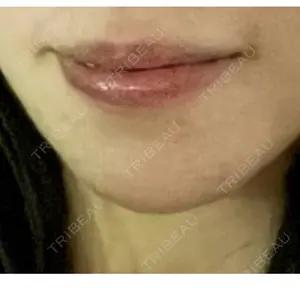 ジョウクリニック ジョウクリニック 大阪院口コミ