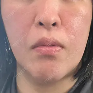 PureMe Skin Clinic（ピュアミースキンクリニック麻布）口コミ