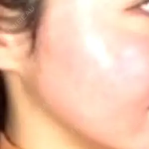 AURORA CLINIC（オーロラクリニック）新宿院口コミ