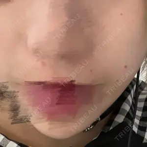 心斎橋KT美容クリニック口コミ