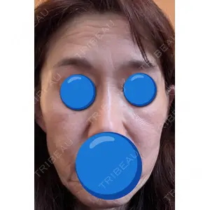 BISIN GINZA CLINIC口コミ