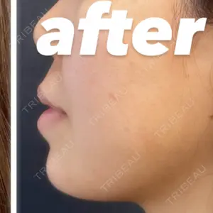 ルラ美容クリニック ルラ美容クリニック 渋谷本院口コミ