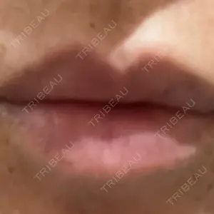 TCB東京中央美容外科 TCB東京中央美容外科 自由が丘院口コミ