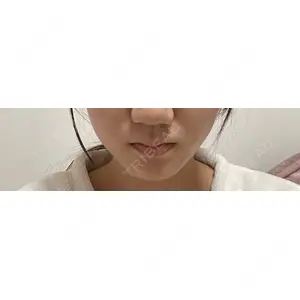 Natural Skin Clinic Natural Skin Clinic 笹塚院口コミ