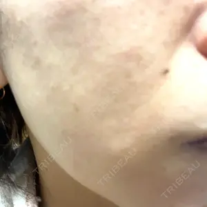 おおかみ美容のクリニック おおかみ美容のクリニック 新宿院口コミ