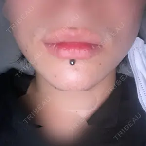 アリエル美容クリニック アリエル美容クリニック 横浜院口コミ