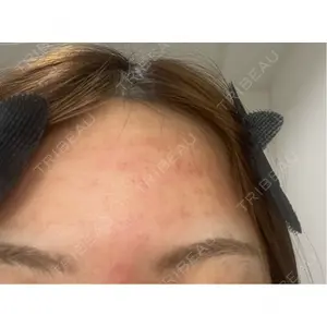 クレオビューティークリニック口コミ