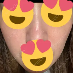 ゆきスキンクリニック 東池袋口コミ