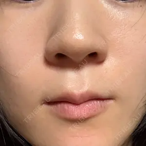 おおかみ美容のクリニック おおかみ美容のクリニック 新宿院口コミ