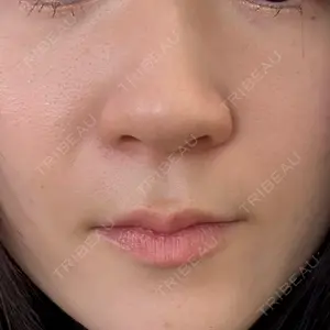 おおかみ美容のクリニック おおかみ美容のクリニック 新宿院口コミ