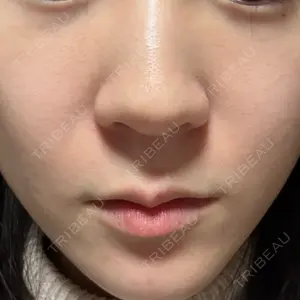 おおかみ美容のクリニック おおかみ美容のクリニック 新宿院口コミ