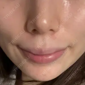 口コミ